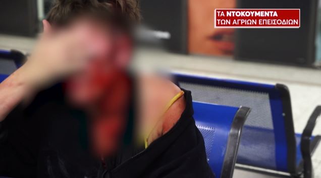 Άγρια-επεισόδια-σε-Βικτώρια-και-Μοναστηράκι-–-Ντοκουμέντα-βίας-στην.jpg