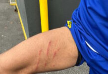 Άρης: Τα σημάδια που άφησε στο πόδι του Ρόουζ το μαρκάρισμα του Ιβανούσετς