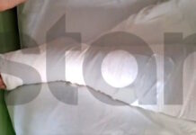 Αίγιο: Σοκάρουν τα τραύματα από τα σκάγια που δέχθηκε 15χρονος όταν 46χρονος πυροβόλησε πισώπλατα ανηλίκους