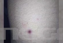 Αίγιο: Νέες φωτογραφίες με τα τραύματα των παιδιών – «Ο 46χρονος έκρυψε την καραμπίνα και πήγε για ύπνο»