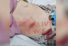 Ηράκλειο: Κοριτσάκι 4,5 χρόνων έπεσε σε φρεάτιο γεμάτο με κοφτερές λαμαρίνες – Τραυματίστηκε στην κοιλιά