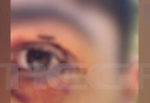 Ιωάννινα: Άγριος ξυλοδαρμός 16χρονου από ανήλικους – «Πήγε βόλτα και κινδύνευσε να χάσει την όρασή του» λέει η μητέρα του