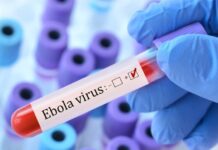 Έμπολα: Ο ΕΟΔΥ επικαιροποιεί τα επιχειρησιακά του σχέδια – «Δεν έχει δυναμική πανδημίας» λέει ο Γκίκας Μαγιορκίνης