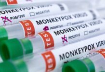 Ευλογιά των πιθήκων: Νέο κρούσμα στην Ελλάδα – 45χρονος νοσηλεύεται στο νοσοκομείο Ιωαννίνων