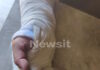 Νίκαια: «Ήμουν πεσμένος στο έδαφος και με κλοτσούσαν», λέει ο οδηγός απορριμματοφόρου που ξυλοκοπήθηκε από την παρέα Πακιστανών