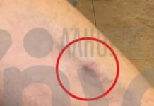 Θριάσιο: 38χρονος ασθενής καταγγέλλει ότι ξυλοκοπήθηκε συνοδό άλλου ασθενούς μέσα στον θάλαμο νοσηλείας