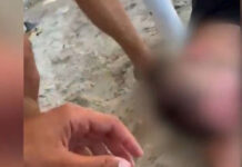 Φωτιά στην Χαλκιδική: Η στιγμή που ναυγοσώστης σώζει πυροσβέστη που έχασε τις αισθήσεις του στην παραλία