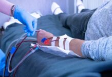 Πλασμαφαίρεση: Το νομικό κενό στην αγορά και χρήση των μηχανημάτων – «Σαν να αγοράζεις αυτοκίνητο χωρίς δίπλωμα»